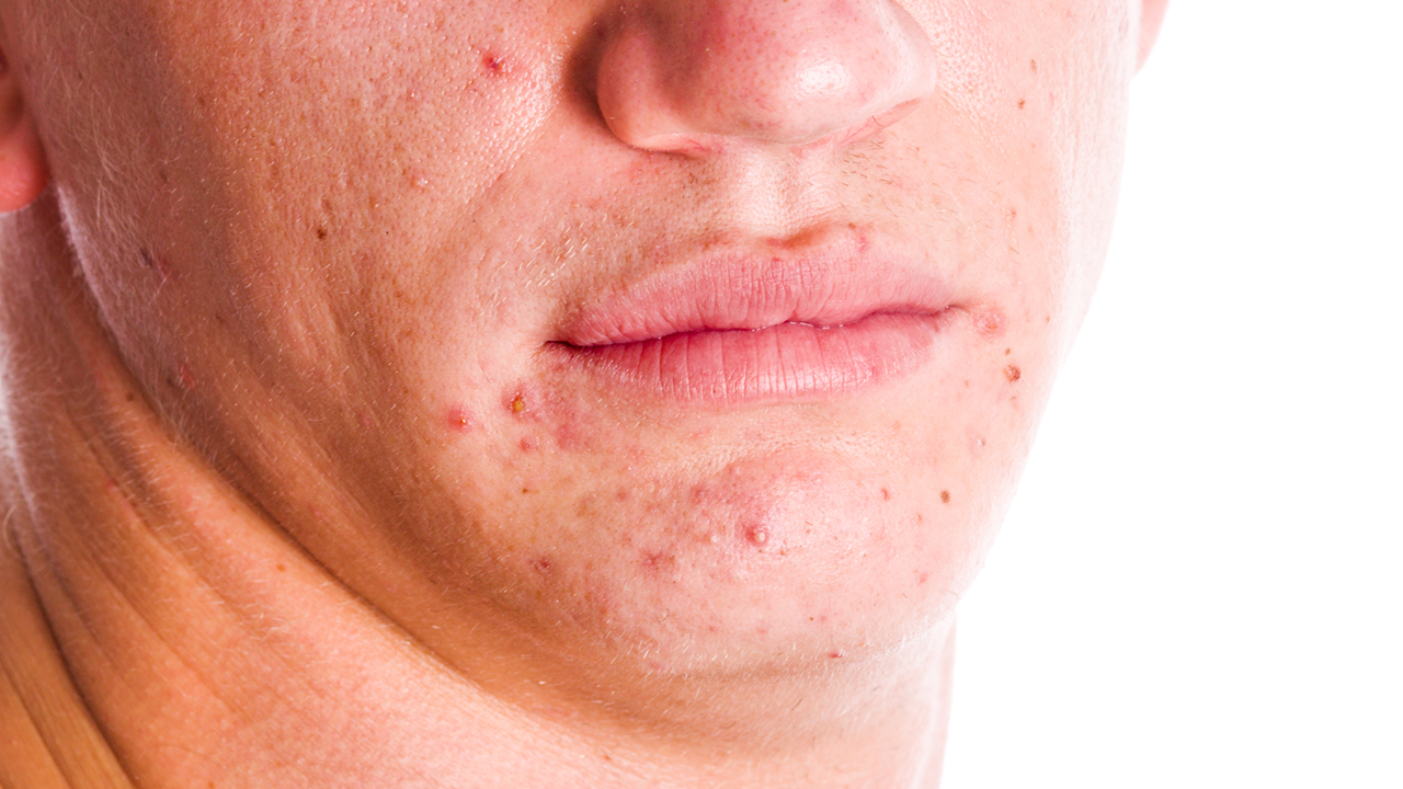脸部皮肤为什么会变的粗糙  脸部皮肤变粗糙的原因是什么