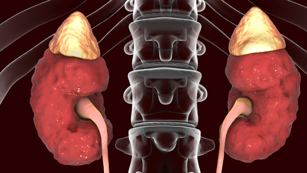 肝肾亏虚吃什么食物能补？细数最滋补肝肾的7大食物