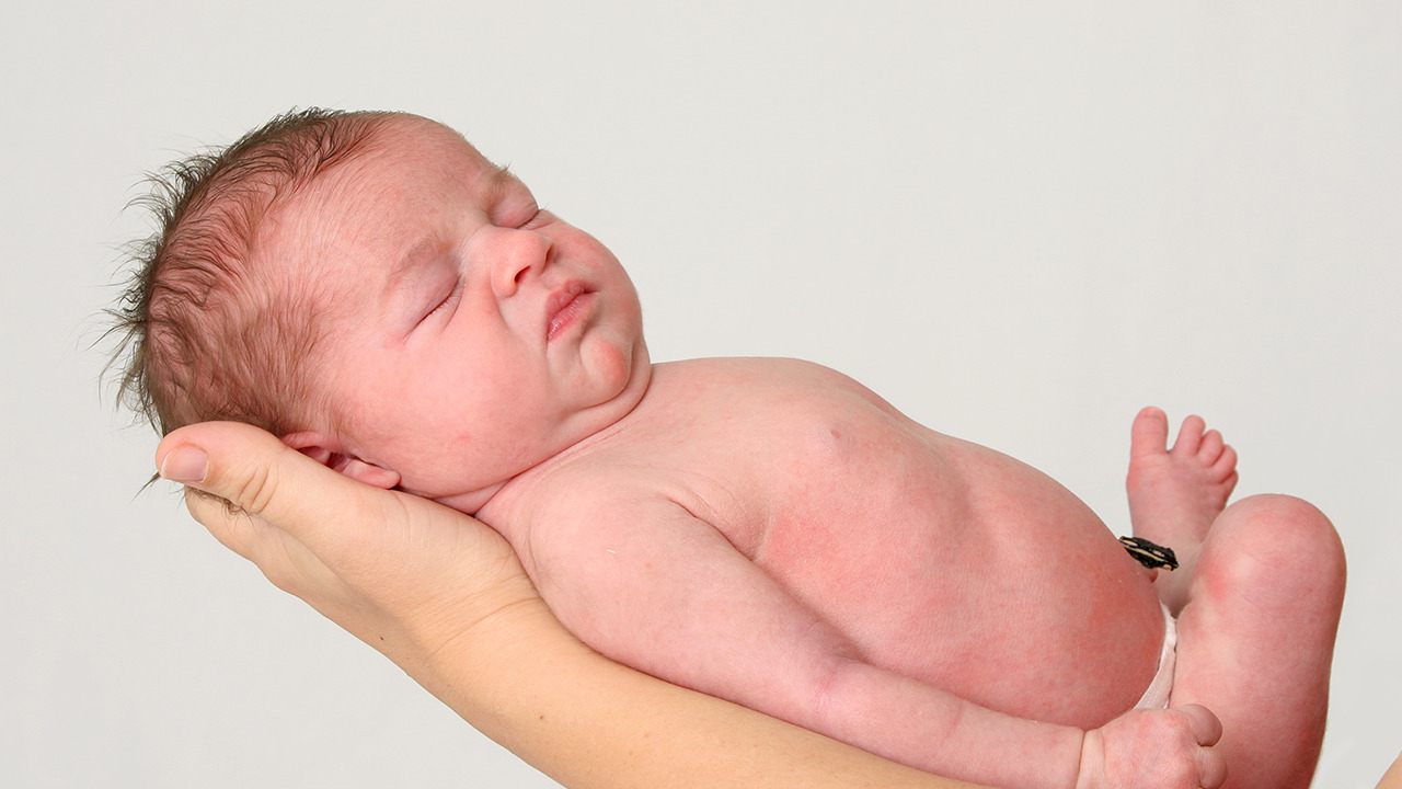 新生儿肚脐眼结痂出血如何护理