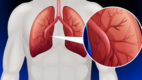 肺感染会有生命危险吗