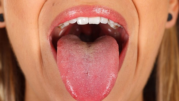 齿痕舌会自愈吗