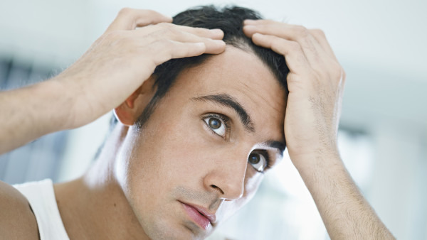 脂溢性脱发怎么治疗